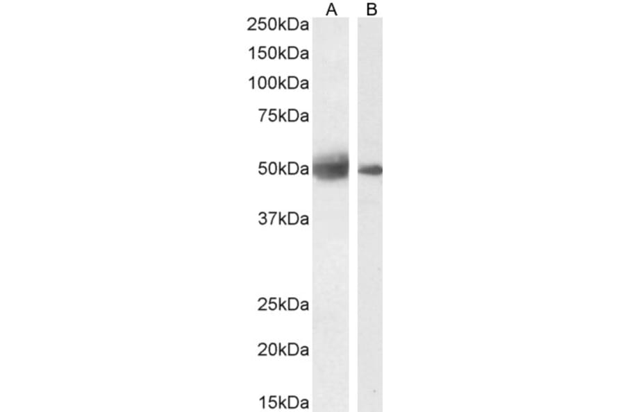 Western Blot - Anti-SEPT4 Antibody (A83090) - Antibodies.com