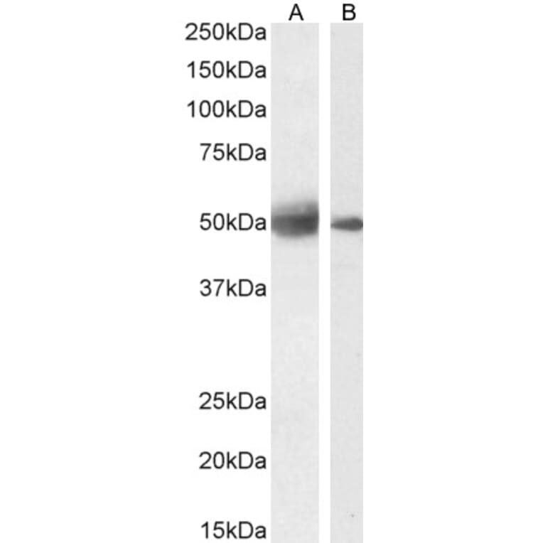 Western Blot - Anti-SEPT4 Antibody (A83090) - Antibodies.com