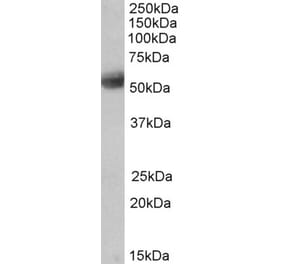 Western Blot - Anti-SEPT4 Antibody (A83090) - Antibodies.com