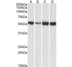 Western Blot - Anti-ATP5A Antibody (A83093) - Antibodies.com