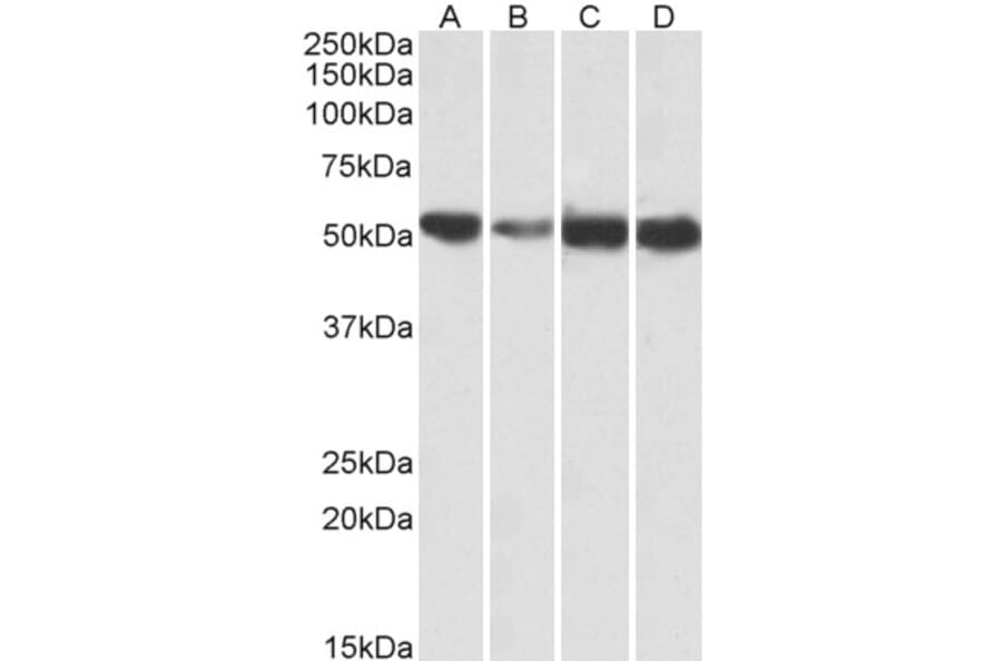 Western Blot - Anti-ATP5A Antibody (A83093) - Antibodies.com