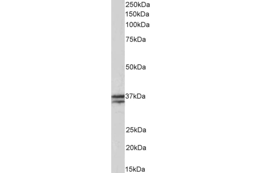 Western Blot - Anti-Troponin T1 Antibody (A83096) - Antibodies.com