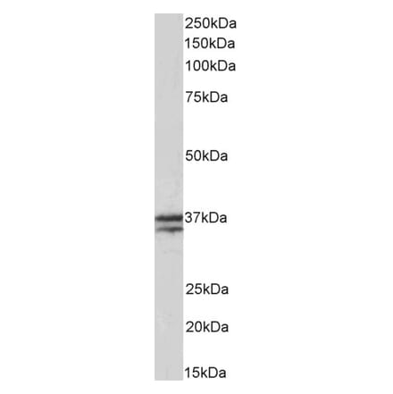 Western Blot - Anti-Troponin T1 Antibody (A83096) - Antibodies.com