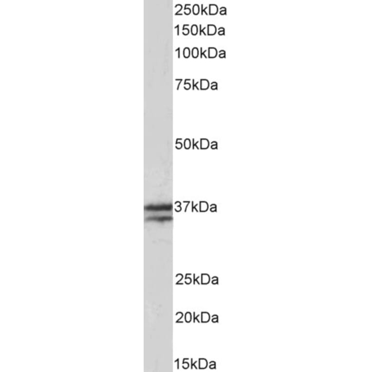 Western Blot - Anti-Troponin T1 Antibody (A83096) - Antibodies.com