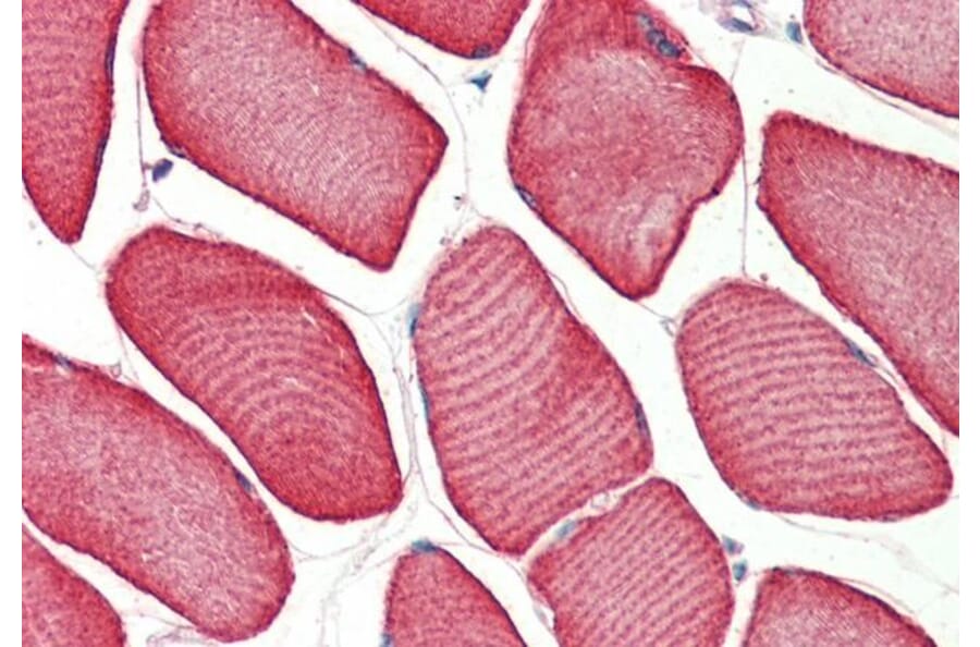 Immunohistochemistry - Anti-Troponin T1 Antibody (A83096) - Antibodies.com