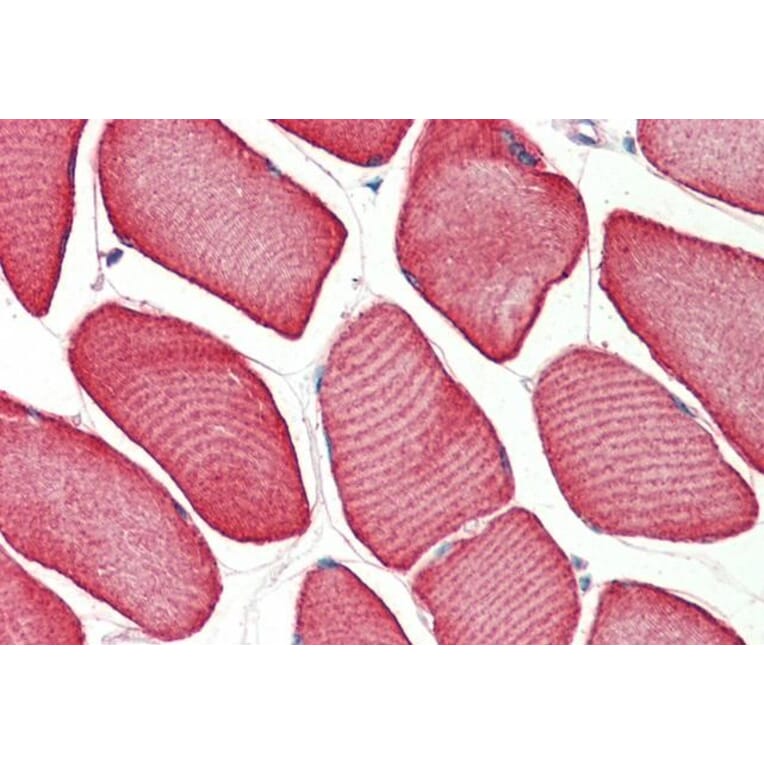 Immunohistochemistry - Anti-Troponin T1 Antibody (A83096) - Antibodies.com