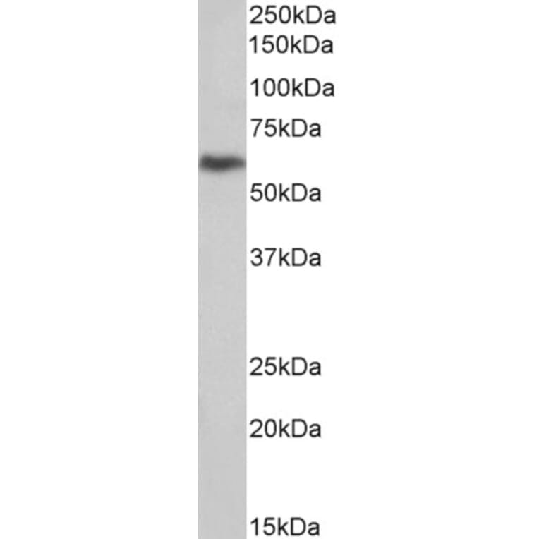Western Blot - Anti-uPA Receptor/U-PAR Antibody (A83097) - Antibodies.com