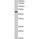 Western Blot - Anti-uPA Receptor/U-PAR Antibody (A83097) - Antibodies.com