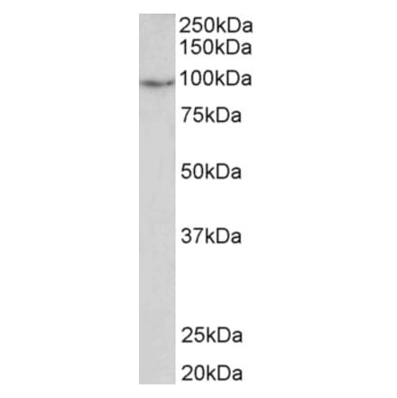 Western Blot - Anti-PDE4B Antibody (A83098) - Antibodies.com