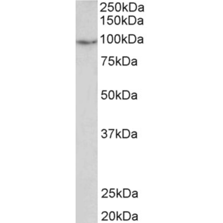 Western Blot - Anti-PDE4B Antibody (A83098) - Antibodies.com