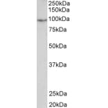 Western Blot - Anti-PDE4B Antibody (A83098) - Antibodies.com