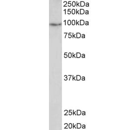 Western Blot - Anti-PDE4B Antibody (A83098) - Antibodies.com