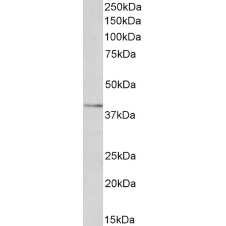 Western Blot - Anti-LOX 1 Antibody (A83101) - Antibodies.com