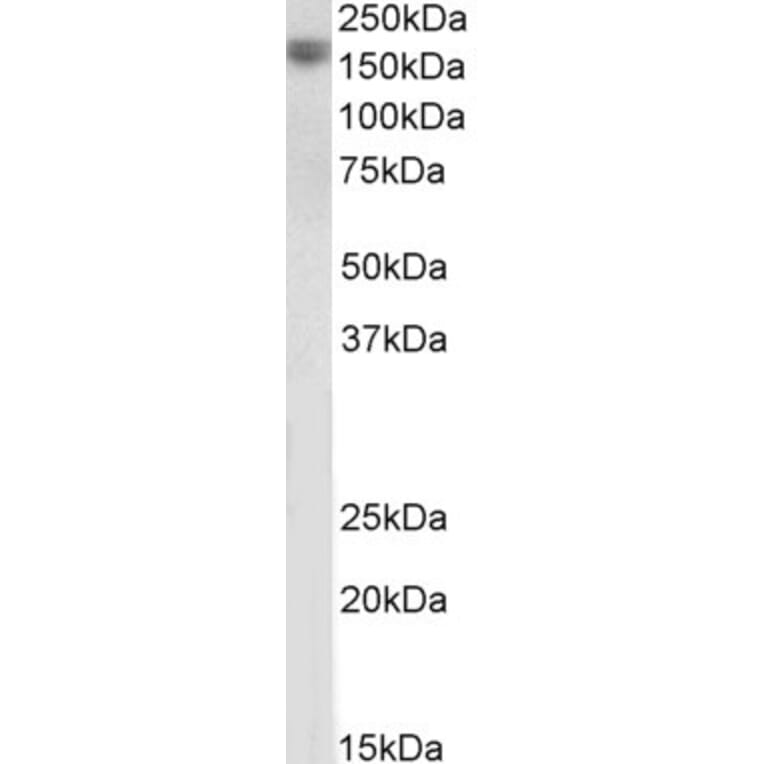 Western Blot - Anti-EGF Antibody (A83104) - Antibodies.com