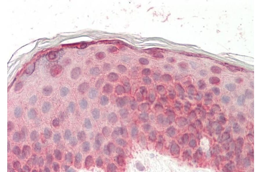 Immunohistochemistry - Anti-EGF Antibody (A83104) - Antibodies.com