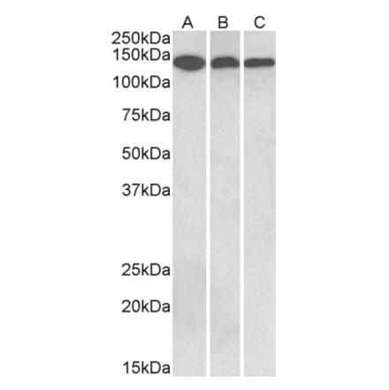 Western Blot - Anti-Contactin 1 Antibody (A83105) - Antibodies.com