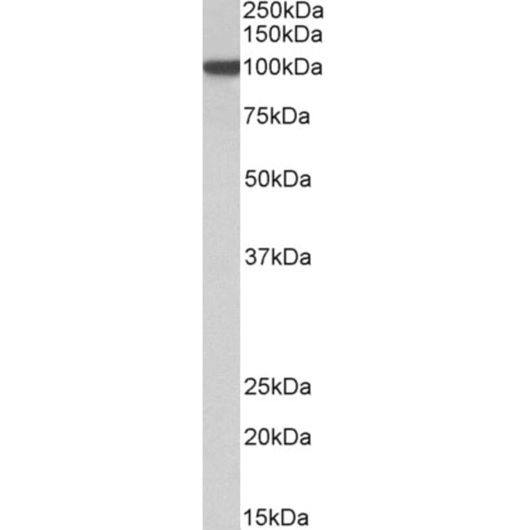 Western Blot - Anti-HIF1 beta Antibody (A83106) - Antibodies.com