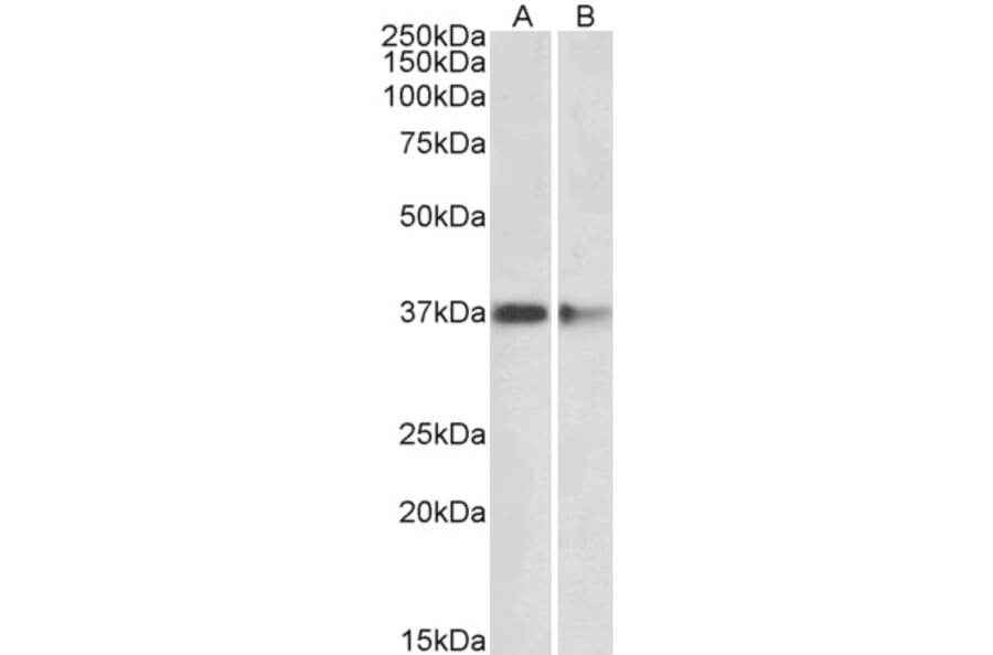 Western Blot - Anti-PRMT2/HMT1 Antibody (A83107) - Antibodies.com