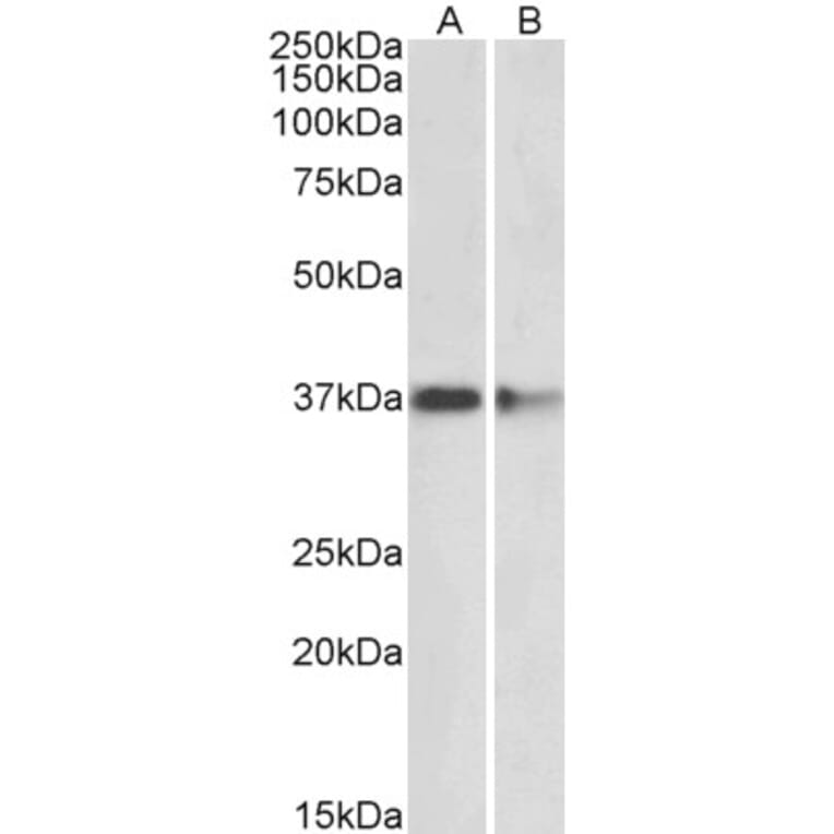 Western Blot - Anti-PRMT2/HMT1 Antibody (A83107) - Antibodies.com