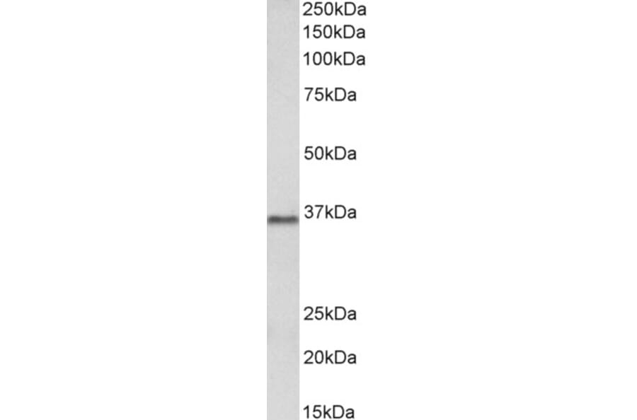 Western Blot - Anti-PRMT2/HMT1 Antibody (A83107) - Antibodies.com