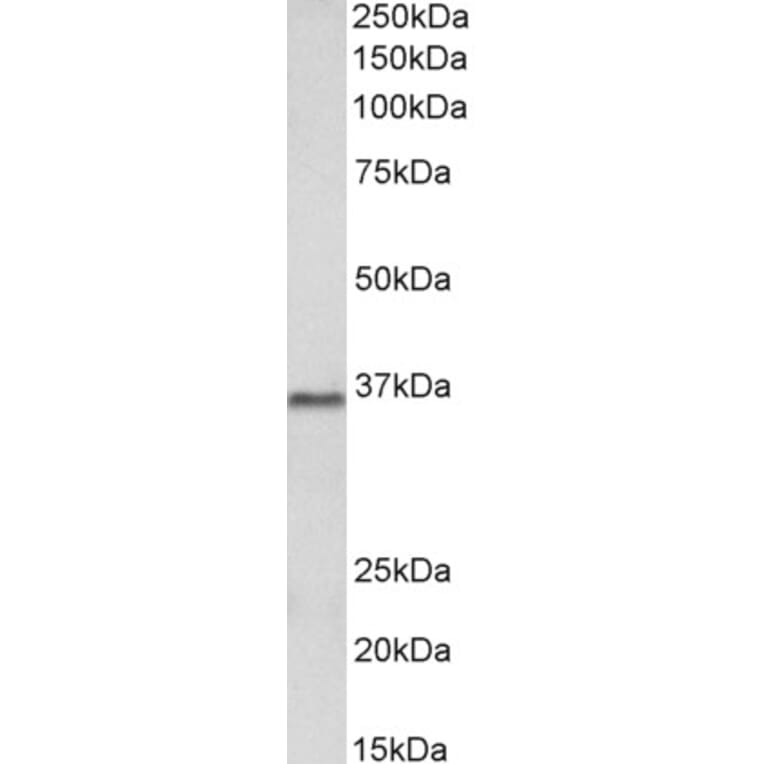 Western Blot - Anti-PRMT2/HMT1 Antibody (A83107) - Antibodies.com
