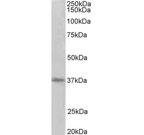 Western Blot - Anti-PRMT2 Antibody (A83107) - Antibodies.com