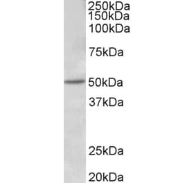 Western Blot - Anti-Estrogen Receptor beta Antibody (A83108) - Antibodies.com