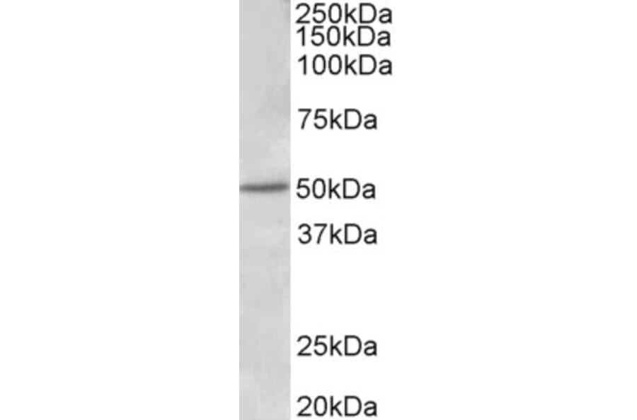 Western Blot - Anti-Estrogen Receptor beta Antibody (A83108) - Antibodies.com
