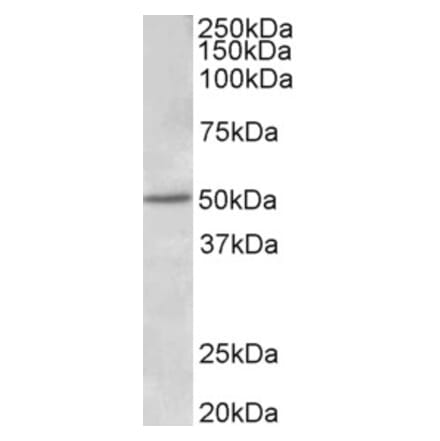 Western Blot - Anti-Estrogen Receptor beta Antibody (A83108) - Antibodies.com