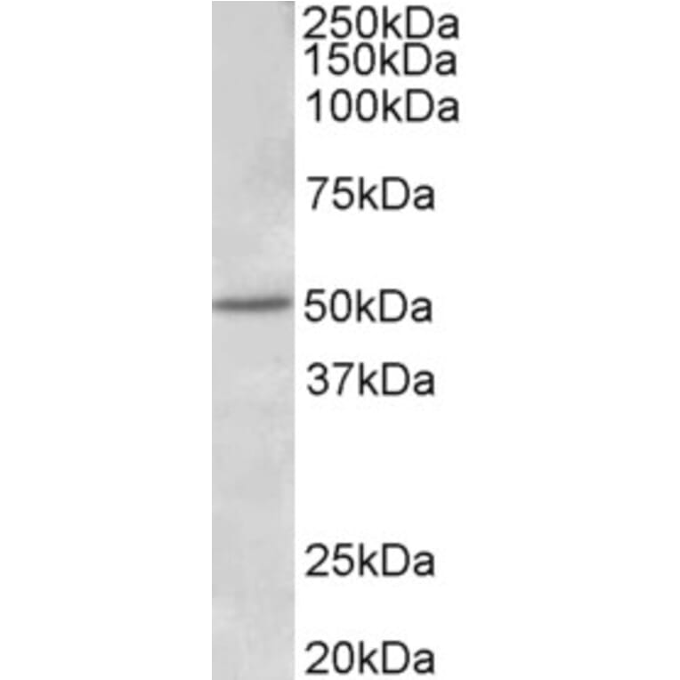 Western Blot - Anti-Estrogen Receptor beta Antibody (A83108) - Antibodies.com