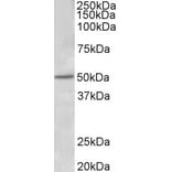 Western Blot - Anti-Estrogen Receptor beta Antibody (A83108) - Antibodies.com