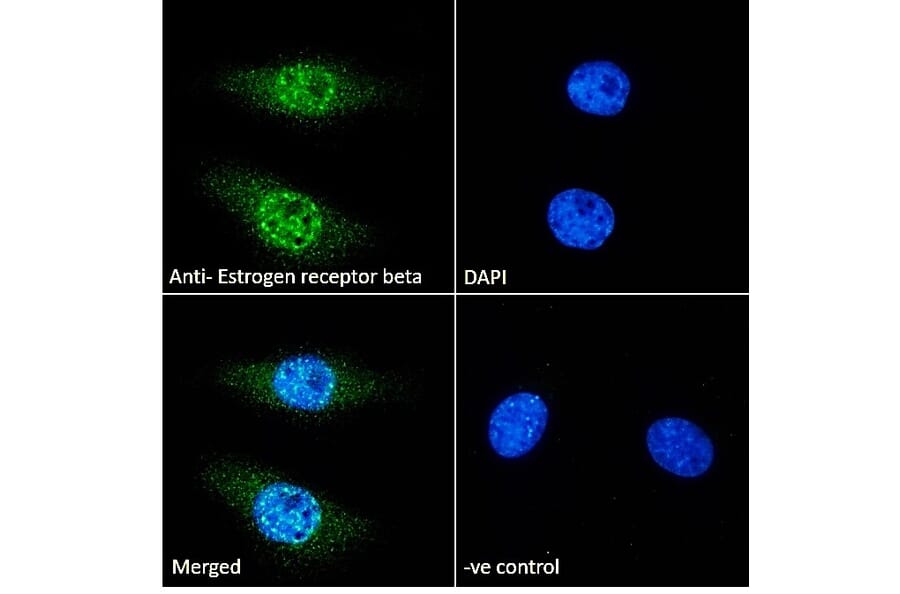 Immunofluorescence - Anti-Estrogen Receptor beta Antibody (A83108) - Antibodies.com