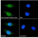 Immunofluorescence - Anti-Estrogen Receptor beta Antibody (A83108) - Antibodies.com