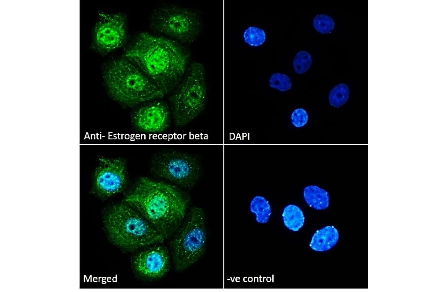 Immunofluorescence - Anti-Estrogen Receptor beta Antibody (A83108) - Antibodies.com
