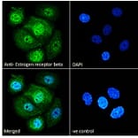 Immunofluorescence - Anti-Estrogen Receptor beta Antibody (A83108) - Antibodies.com