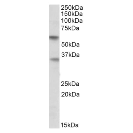 Western Blot - Anti-SIGLEC6 Antibody (A83110) - Antibodies.com