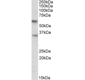 Western Blot - Anti-SIGLEC6 Antibody (A83110) - Antibodies.com