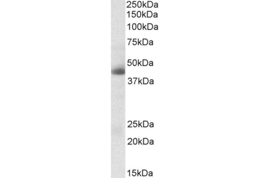 Western Blot - Anti-Carbonic Anhydrase 12/CA12 Antibody (A83111) - Antibodies.com