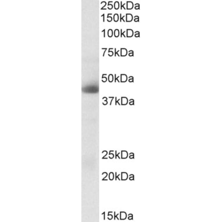 Western Blot - Anti-Carbonic Anhydrase 12/CA12 Antibody (A83111) - Antibodies.com