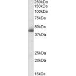 Western Blot - Anti-Carbonic Anhydrase 12/CA12 Antibody (A83111) - Antibodies.com