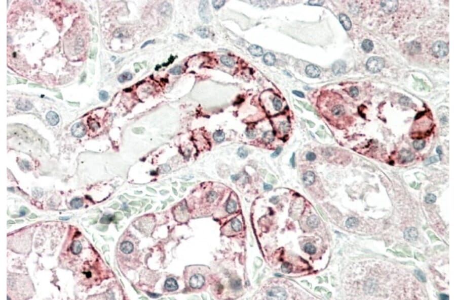 Immunohistochemistry - Anti-Carbonic Anhydrase 12/CA12 Antibody (A83111) - Antibodies.com