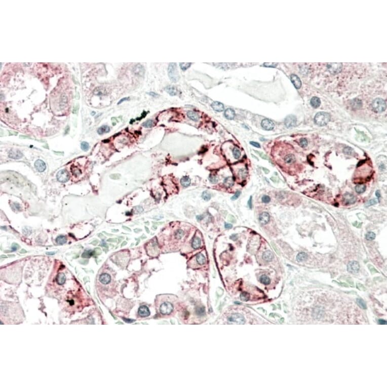 Immunohistochemistry - Anti-Carbonic Anhydrase 12/CA12 Antibody (A83111) - Antibodies.com