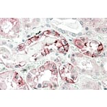 Immunohistochemistry - Anti-Carbonic Anhydrase 12/CA12 Antibody (A83111) - Antibodies.com