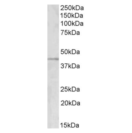 Western Blot - Anti-GRAMD3 Antibody (A83115) - Antibodies.com