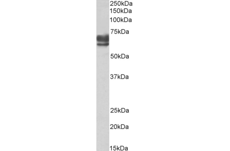 Western Blot - Anti-PEX5/PER3 Antibody (A83117) - Antibodies.com