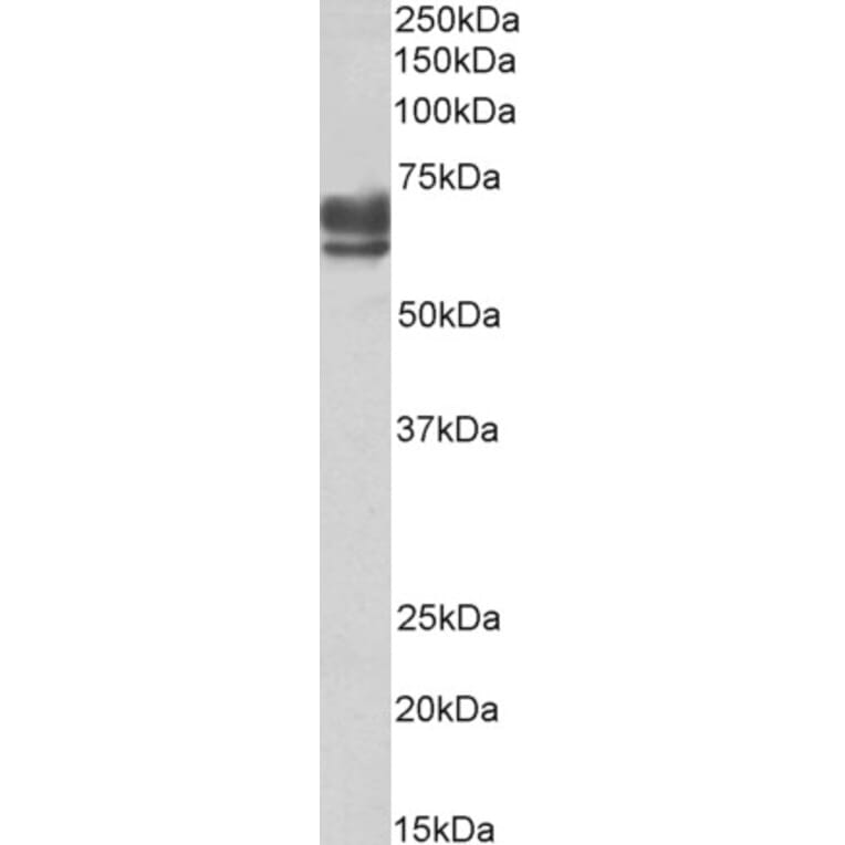 Western Blot - Anti-PEX5/PER3 Antibody (A83117) - Antibodies.com