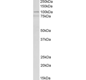 Western Blot - Anti-ACTN1 Antibody (A83118) - Antibodies.com