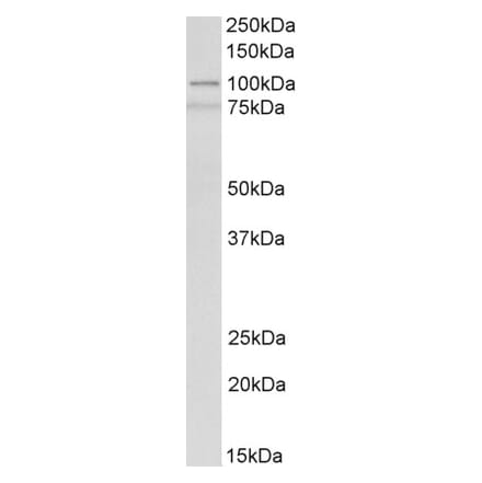 Western Blot - Anti-ACTN1 Antibody (A83118) - Antibodies.com