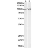Western Blot - Anti-ACTN1 Antibody (A83118) - Antibodies.com