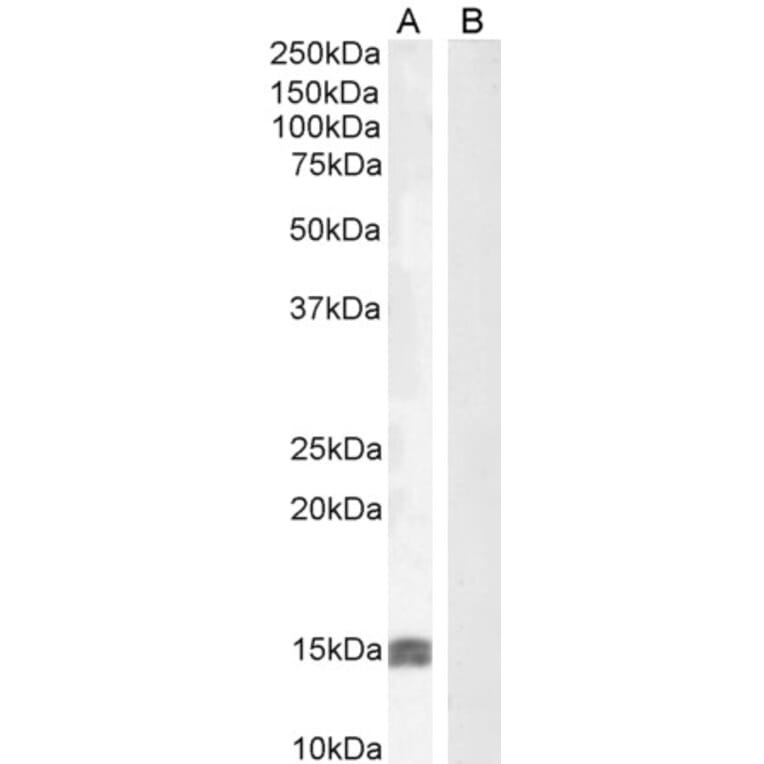 Western Blot - Anti-IGF1 Antibody (A83119) - Antibodies.com